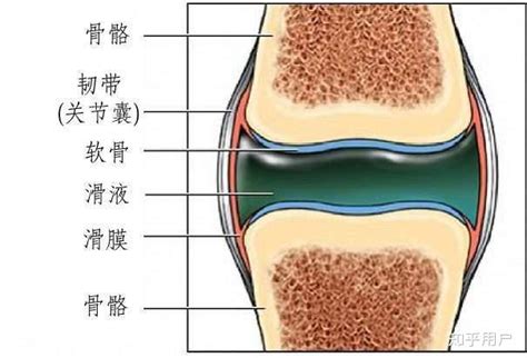 滑膜炎可以健身吗